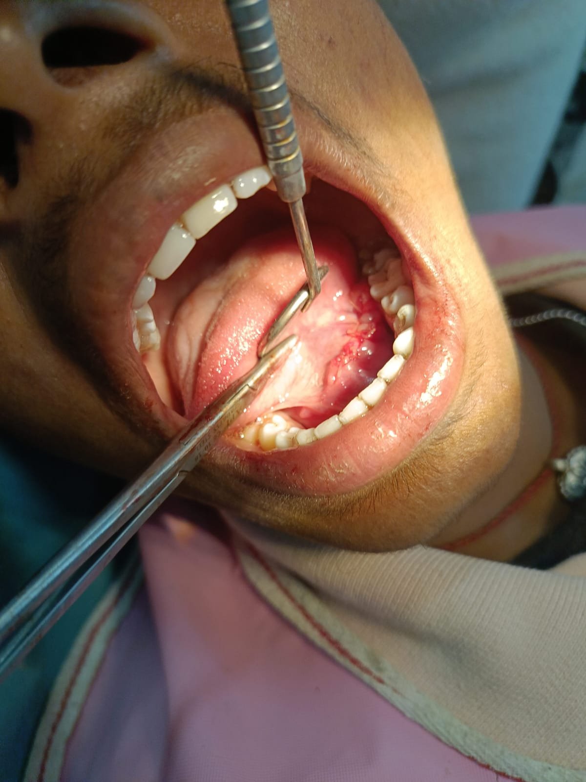 Patient resting comfortably in the dental chair with apron during treatment
